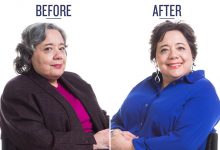 before and after photo