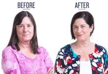 before and after photo