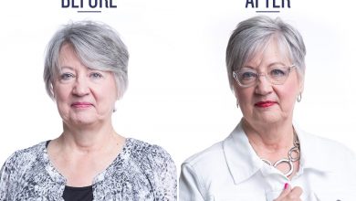 before and after photo