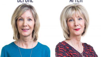 before and after photo