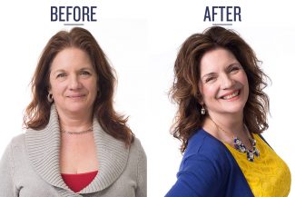 Type 1 woman's before and after